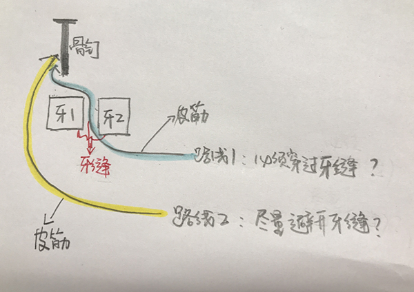 患者投稿丨一位正畸小姐姐的《看牙記》